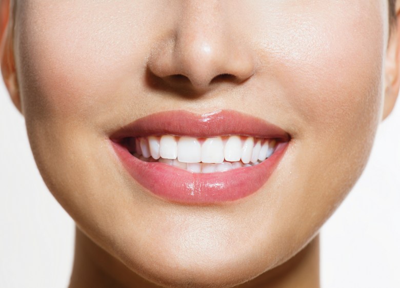 Teeth-Whitening-Irvine-2